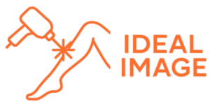 הסרת שיער בלייזר